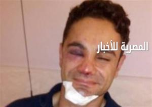 الضابط المُصاب فى حفل  "محمد حماقي "يروي تفاصيل الواقعة: لن أتصالح