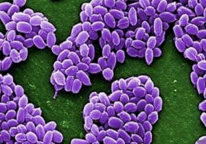الجيش الأمريكي يبعث بالخطأ بكتيريا الجمرة الخبيثة حية إلى مختبرات في أنحاء أمريكا