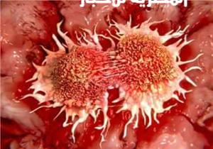 إكتشاف علاج يقتل الخلايا السرطانية فى 60 ثانية فقط