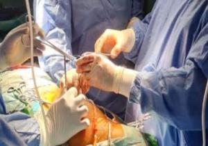 إجراء عملية جراحة قلب بالمنظار لتغيير الصمامات بمستشفى المنصورة الدولى