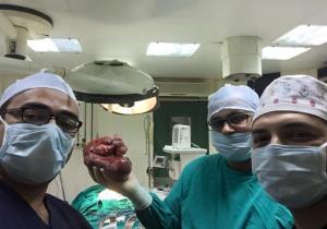 فريق جراحة بمستشفى الأطفال بجامعة المنصورة ينجح في استئصال ورم نادر لطفل عمره 3 أشهر