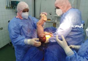 "صحة الدقهلية": نجاح ولادة قيصرية لسيدة مصابة بكورونا