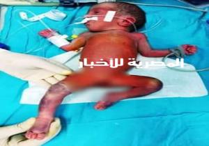الإهمال الطبي عرض مستمر