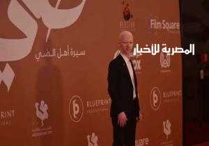 بدر محمد: فخور بكوني أول ممثل "ألبينو" يتصدر بطولة فيلم عربي