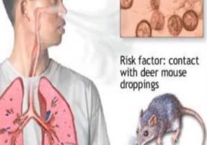 فيروس هانتا Hantavirus يتصدر التريند العالمى بعد تسجيله أول حالة وفاة بالصين