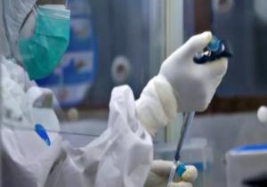 روسيا تنشر مراكز اختبار سريع مجانى لفيروس كورونا عقب ارتفاع الاصابات